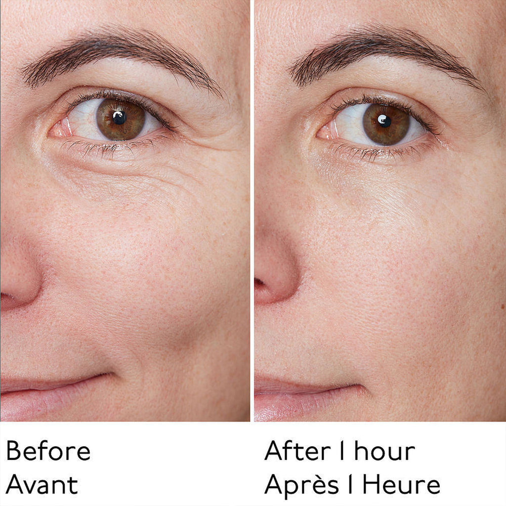 Skinnova Instant Lift Balm – Look Younger in Minutes