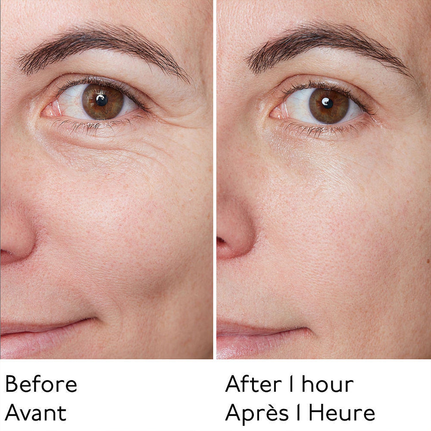 Skinnova Instant Lift Balm – Look Younger in Minutes